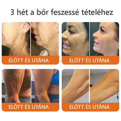 📦 Bőrgyógyász ajánlása ✨ ZödVita® Méhméreg Bőr Helyreállító Krém 🔥 Magyar fejlesztés, magyarországi gyártás és szállítás
