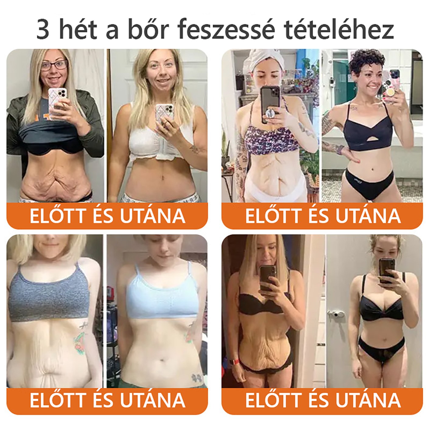 📦 Bőrgyógyász ajánlása ✨ ZödVita® Méhméreg Bőr Helyreállító Krém 🔥 Magyar fejlesztés, magyarországi gyártás és szállítás