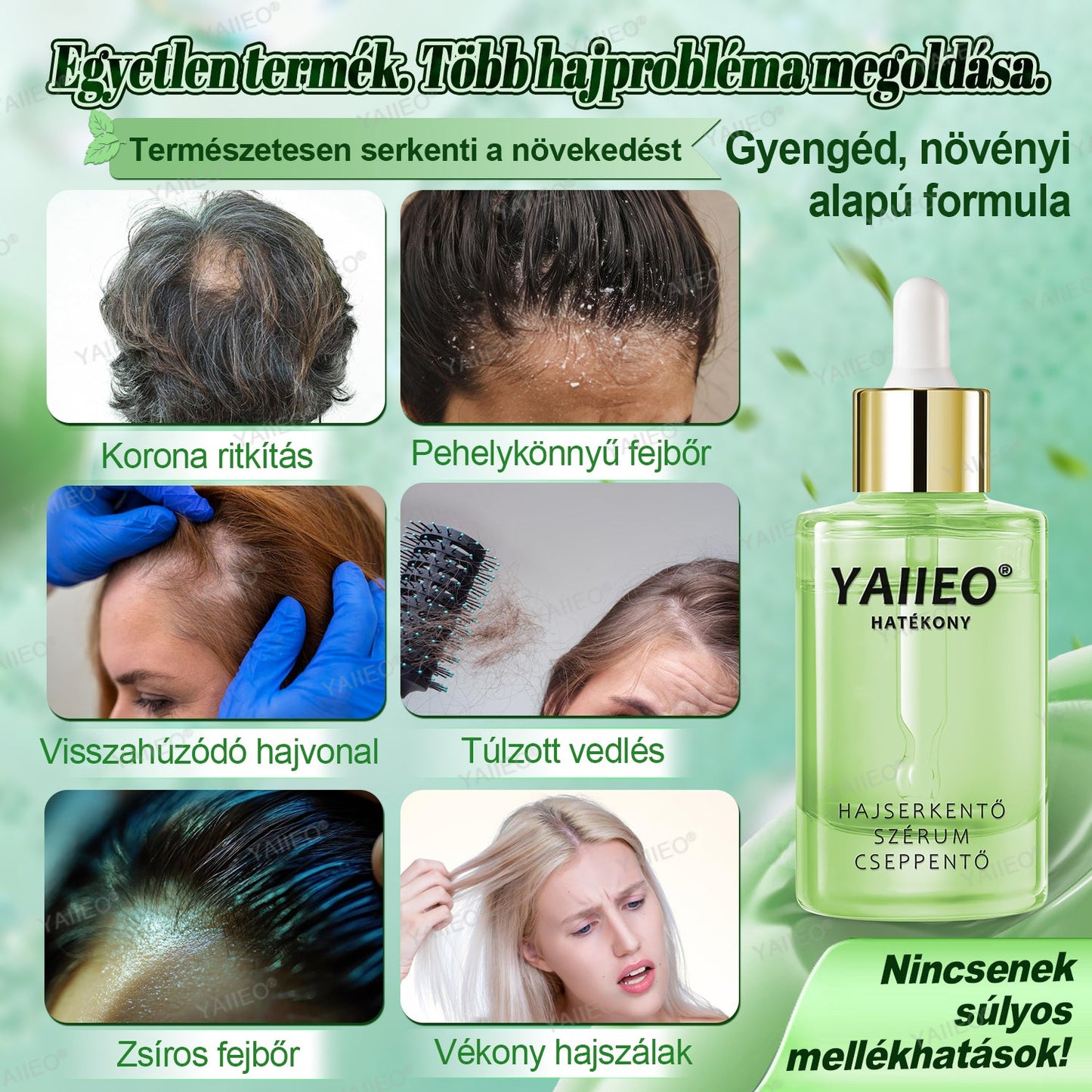 🌿 𝒀𝑨𝑰𝑰𝑬𝑶® 𝑯𝒂𝒋𝒔𝒆𝒓𝒌𝒆𝒏𝒕ő 𝑺𝒛é𝒓𝒖𝒎 – 𝑭á𝒋𝒅𝒂𝒍𝒐𝒎𝒎𝒆𝒏𝒕𝒆𝒔 𝑯𝒂𝒋á𝒑𝒐𝒍á𝒔 Közvetlenül a hajhagymák gyökeréig · 4 hét alatt újraéleszti az alvó tüszőket · EU CE tanúsítvány