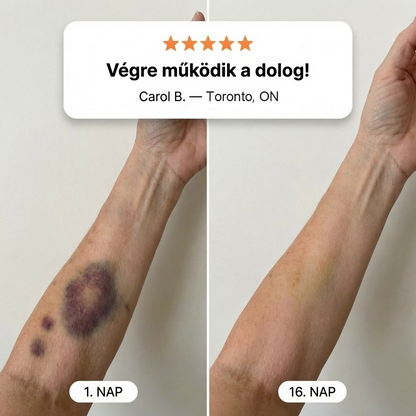 👉100K+ ELADVA 💁‍♀️ – PuraCure® Zúzódásjavító és bőrerősítő krém