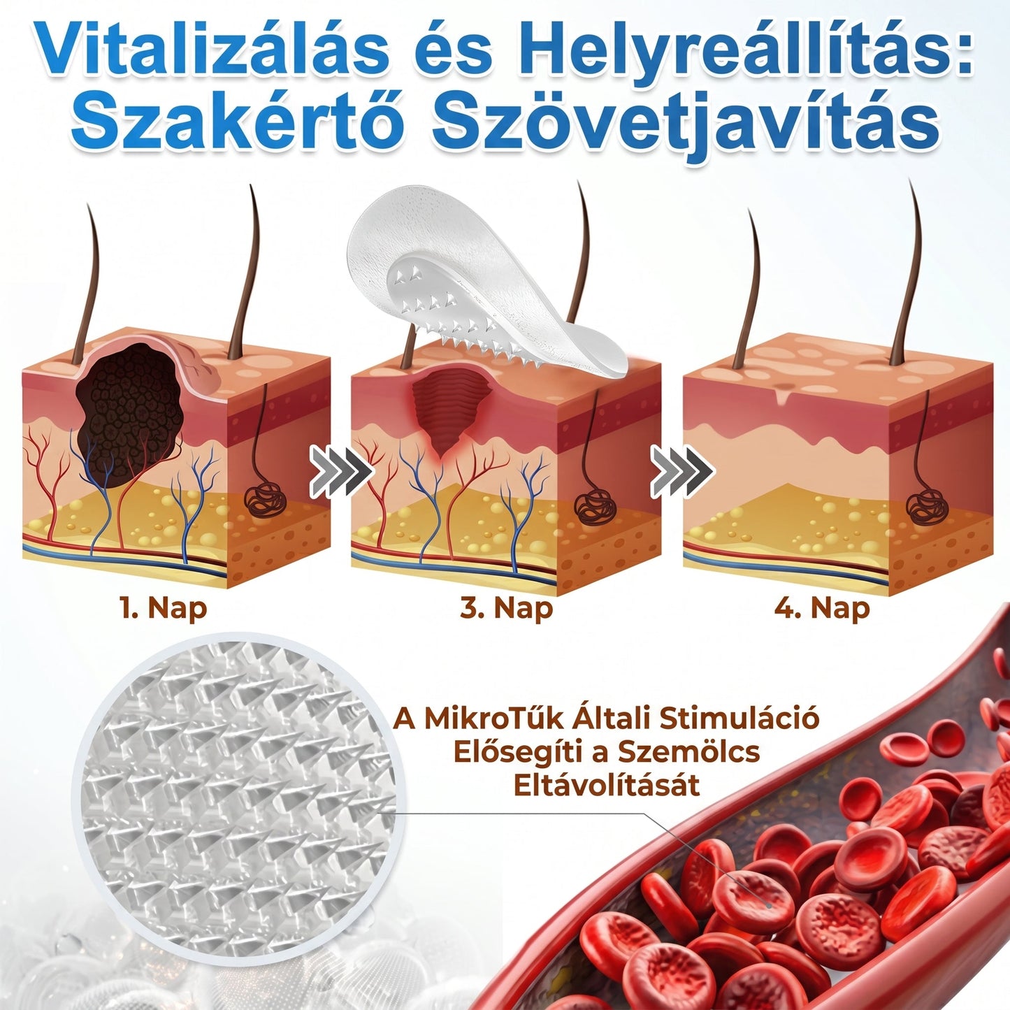 ✨ PuraCure® 2 az 1-ben mikrotűs és hidrokolloid tapasz🍀 | Kiálló anyajegyek, aknék, lapos szemölcsök és bőrnövedékek eltávolítására | Segít csökkenteni a ráncokat, hegeket és bőrhibákat | Láthatatlan tapasz az arcra és testre