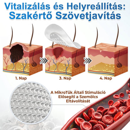 ✨ PuraCure® 2 az 1-ben mikrotűs és hidrokolloid tapasz🍀 | Kiálló anyajegyek, aknék, lapos szemölcsök és bőrnövedékek eltávolítására | Segít csökkenteni a ráncokat, hegeket és bőrhibákat | Láthatatlan tapasz az arcra és testre