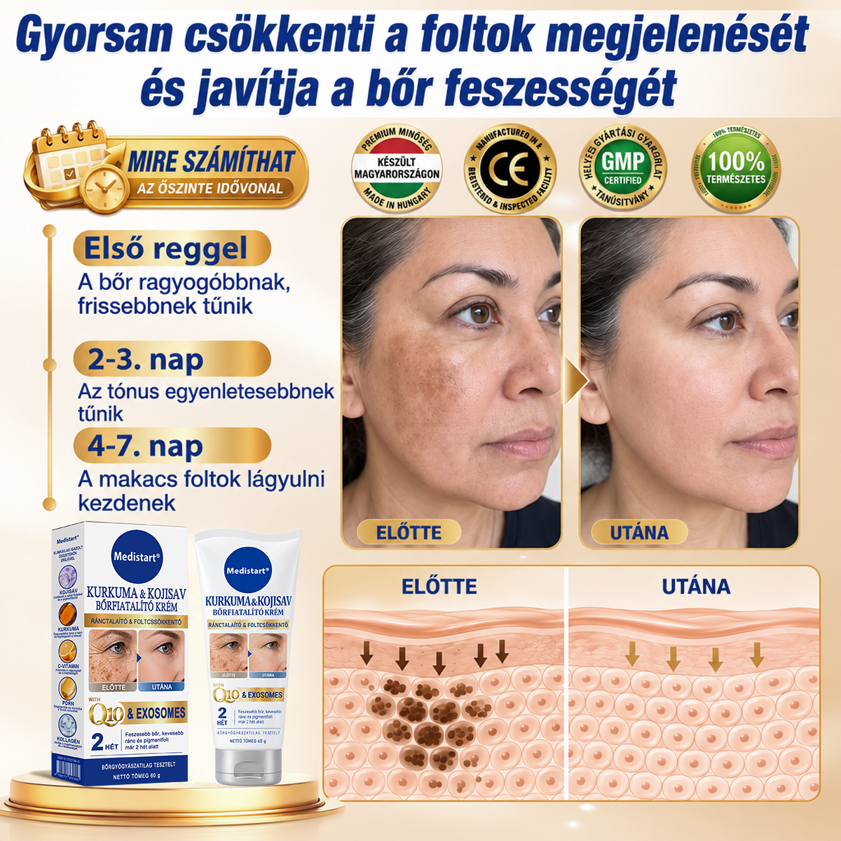 ✨𝑯𝒊𝒗𝒂𝒕𝒂𝒍𝒐𝒔 𝑼̈𝒛𝒍𝒆𝒕 | 𝐔́𝐣! ✨ Medistart® 𝐊𝐮𝐫𝐤𝐮𝐦𝐚 × 𝐊𝐨𝐣𝐢𝐧𝐬𝐚𝐯 𝐄́𝐣𝐬𝐳𝐚𝐤𝐚𝐢 Bőrfiatalító 𝐊𝐫𝐞́𝐦— 𝐇𝐚𝐥𝐯𝐚́𝐧𝐲𝐢́𝐭𝐬𝐝 𝐚 𝐦𝐚𝐤𝐚𝐜𝐬 𝐬𝐨̈𝐭𝐞́𝐭 𝐟𝐨𝐥𝐭𝐨𝐤𝐚𝐭 𝐞́𝐬 𝐬𝐢𝐦𝐢́𝐭𝐬𝐝 𝐤𝐢 𝐚 𝐥𝐚́𝐭𝐡𝐚𝐭𝐨́ 𝐫𝐚́𝐧𝐜𝐨𝐤𝐚𝐭 𝐚𝐥𝐯𝐚́𝐬 𝐤𝐨̈𝐳𝐛𝐞𝐧 🌙 ✅ 𝐄́𝐣𝐬𝐳𝐚𝐤𝐚́𝐧𝐤𝐞́𝐧𝐭 𝐞𝐠𝐲 𝐥𝐞́𝐩𝐞́𝐬 · 𝐋𝐚́𝐭𝐡𝐚𝐭𝐨́ 𝐯𝐚́𝐥𝐭𝐨𝐳𝐚́𝐬 𝟕 𝐞́𝐣𝐬𝐳𝐚𝐤𝐚 𝐚𝐥𝐚𝐭𝐭 💯