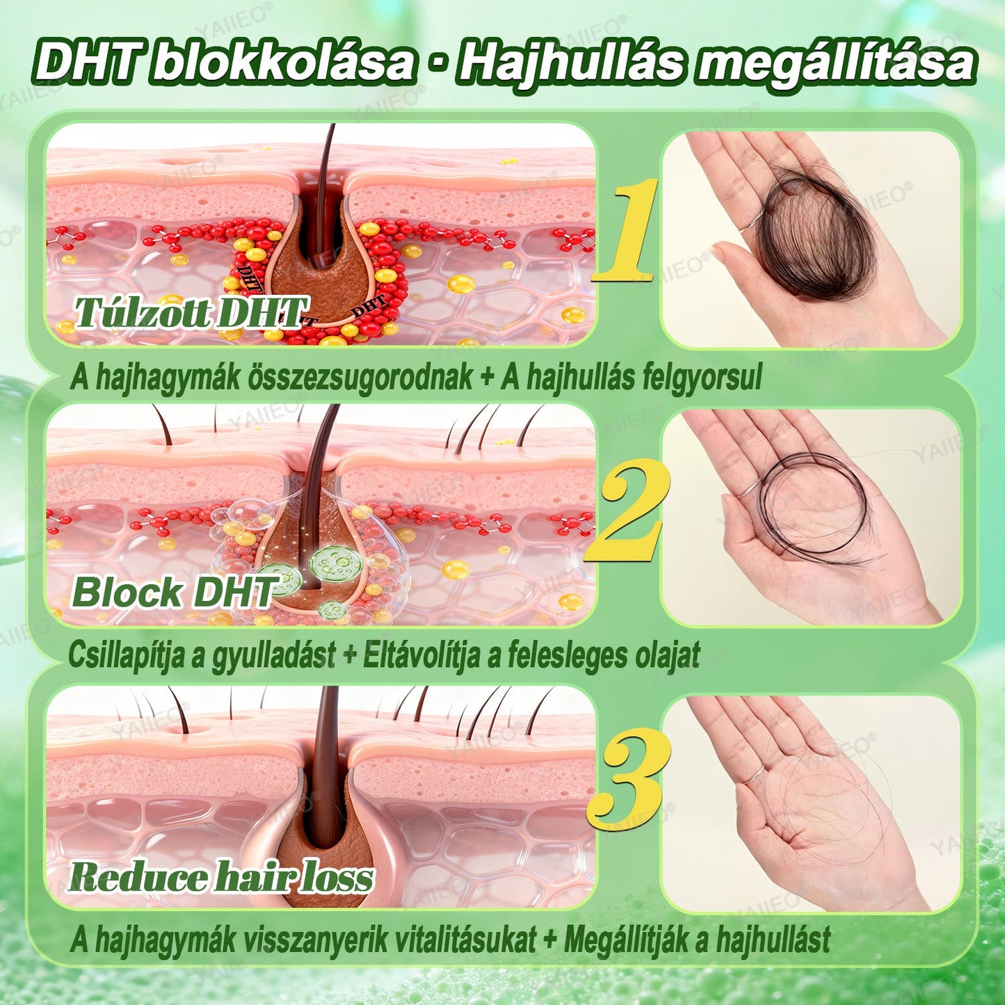 🌿 𝒀𝑨𝑰𝑰𝑬𝑶® 𝑯𝒂𝒋𝒔𝒆𝒓𝒌𝒆𝒏𝒕ő 𝑺𝒛é𝒓𝒖𝒎 – 𝑭á𝒋𝒅𝒂𝒍𝒐𝒎𝒎𝒆𝒏𝒕𝒆𝒔 𝑯𝒂𝒋á𝒑𝒐𝒍á𝒔 Közvetlenül a hajhagymák gyökeréig · 4 hét alatt újraéleszti az alvó tüszőket · EU CE tanúsítvány