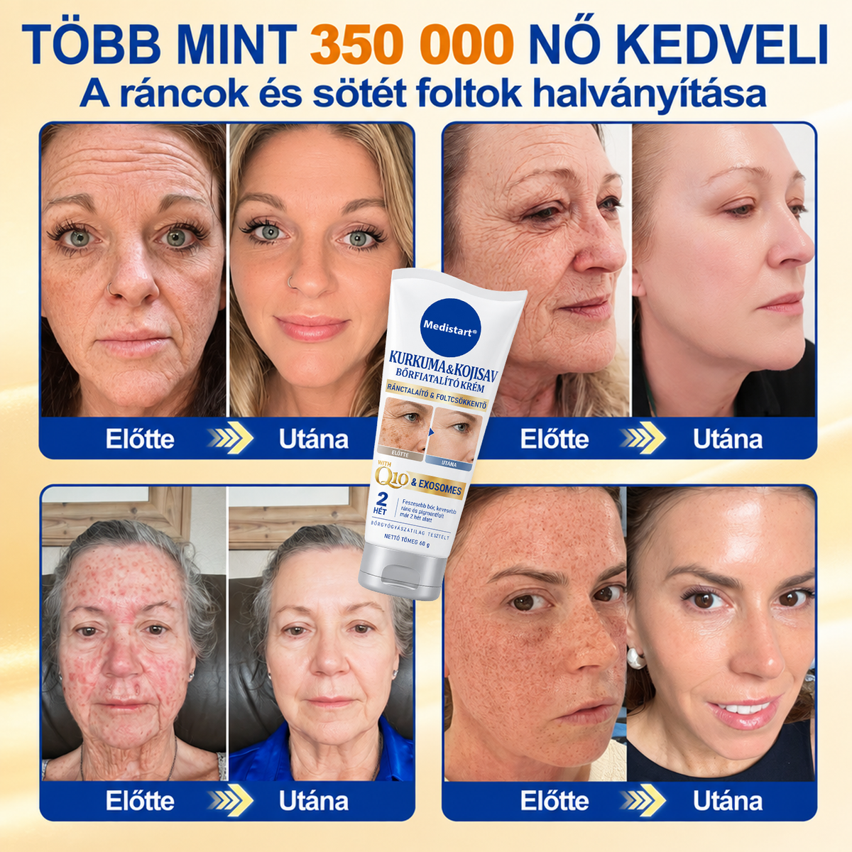 ✨𝑯𝒊𝒗𝒂𝒕𝒂𝒍𝒐𝒔 𝑼̈𝒛𝒍𝒆𝒕 | 𝐔́𝐣! ✨ Medistart® 𝐊𝐮𝐫𝐤𝐮𝐦𝐚 × 𝐊𝐨𝐣𝐢𝐧𝐬𝐚𝐯 𝐄́𝐣𝐬𝐳𝐚𝐤𝐚𝐢 Bőrfiatalító 𝐊𝐫𝐞́𝐦— 𝐇𝐚𝐥𝐯𝐚́𝐧𝐲𝐢́𝐭𝐬𝐝 𝐚 𝐦𝐚𝐤𝐚𝐜𝐬 𝐬𝐨̈𝐭𝐞́𝐭 𝐟𝐨𝐥𝐭𝐨𝐤𝐚𝐭 𝐞́𝐬 𝐬𝐢𝐦𝐢́𝐭𝐬𝐝 𝐤𝐢 𝐚 𝐥𝐚́𝐭𝐡𝐚𝐭𝐨́ 𝐫𝐚́𝐧𝐜𝐨𝐤𝐚𝐭 𝐚𝐥𝐯𝐚́𝐬 𝐤𝐨̈𝐳𝐛𝐞𝐧 🌙 ✅ 𝐄́𝐣𝐬𝐳𝐚𝐤𝐚́𝐧𝐤𝐞́𝐧𝐭 𝐞𝐠𝐲 𝐥𝐞́𝐩𝐞́𝐬 · 𝐋𝐚́𝐭𝐡𝐚𝐭𝐨́ 𝐯𝐚́𝐥𝐭𝐨𝐳𝐚́𝐬 𝟕 𝐞́𝐣𝐬𝐳𝐚𝐤𝐚 𝐚𝐥𝐚𝐭𝐭 💯