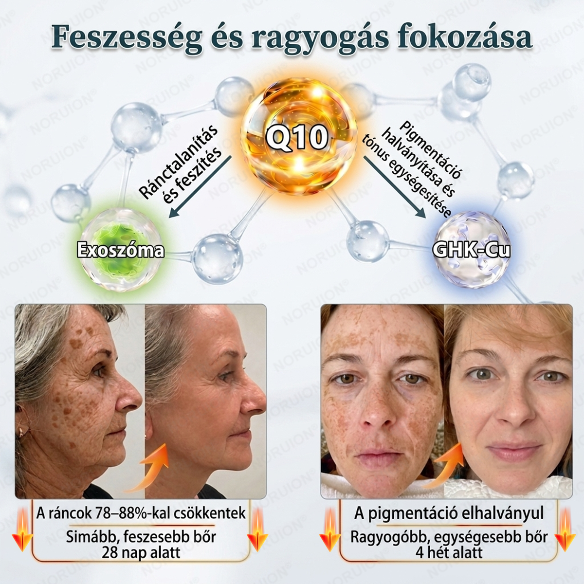 🌿 NORUION® Q10 + növényi nano-exoszóma fejlett ránctalanító krém