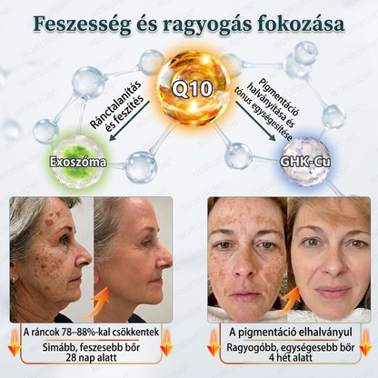 🌿 NORUION® Q10 + növényi nano-exoszóma fejlett ránctalanító krém