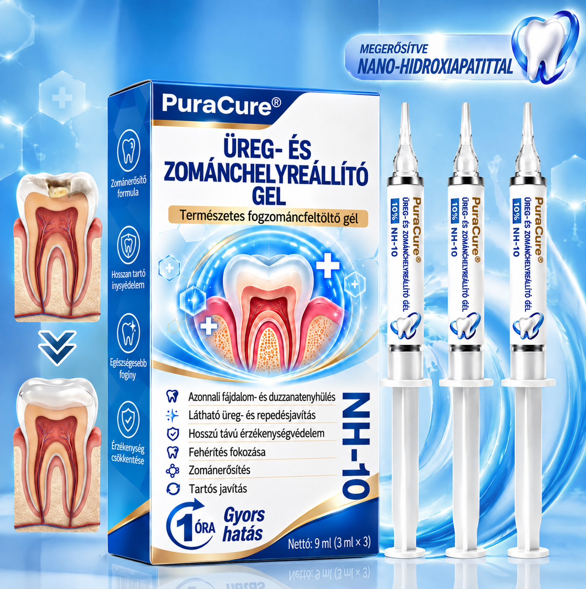 🌟PuraCure®  Üregjavító Természetes Zománctömő Gél