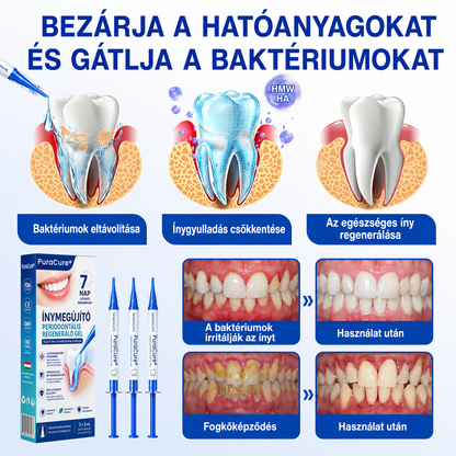🇭🇺👨‍⚕️🌲🦷 PuraCure® ÍNYMEGÚJÍTÓ – Parodontális helyreállító gél🧂