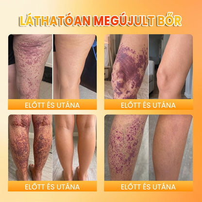 ✨ PuraCure® MÉHMÉREG Bőrmegújító krém