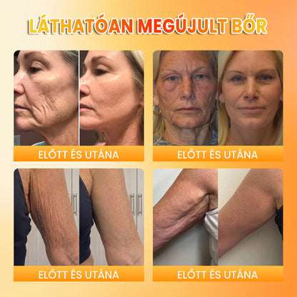 ✨ PuraCure® MÉHMÉREG Bőrmegújító krém