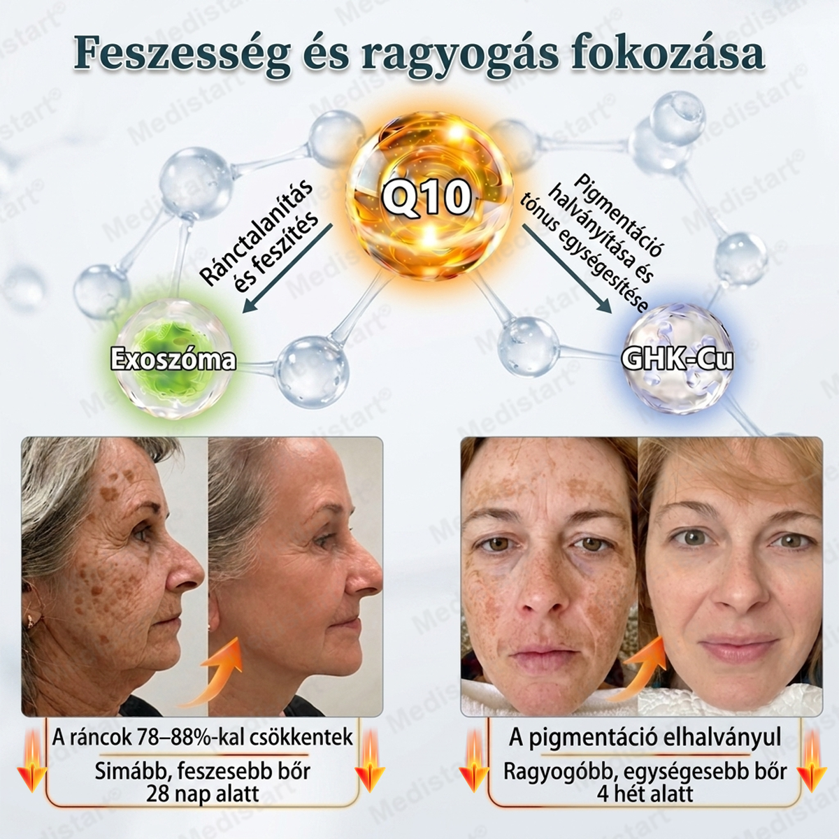 ✅ Medistart® Q10 + növényi nano-exoszóma fejlett ránctalanító krém