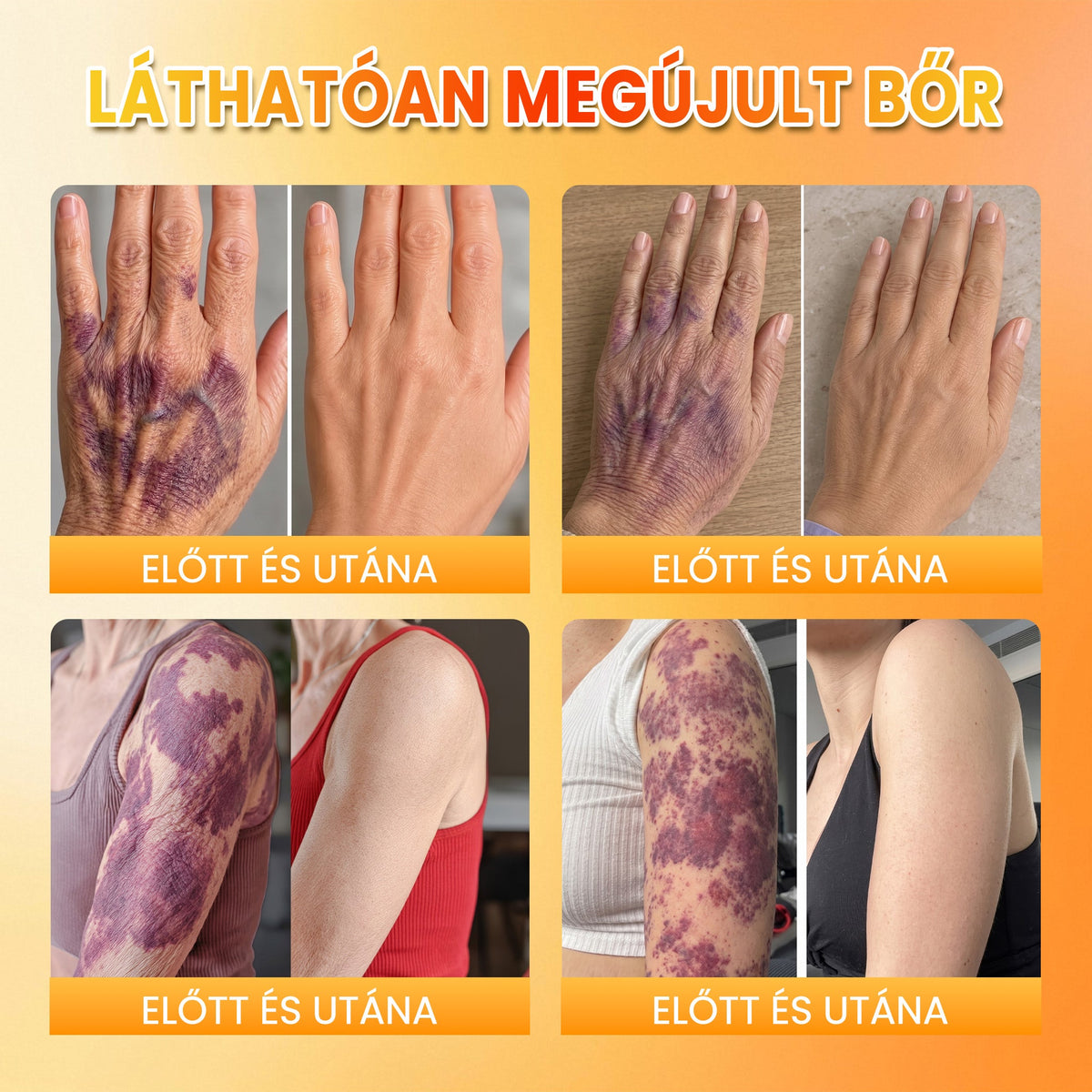 ✨ PuraCure® MÉHMÉREG Bőrmegújító krém
