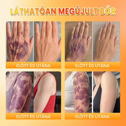 ✨ PuraCure® MÉHMÉREG Bőrmegújító krém