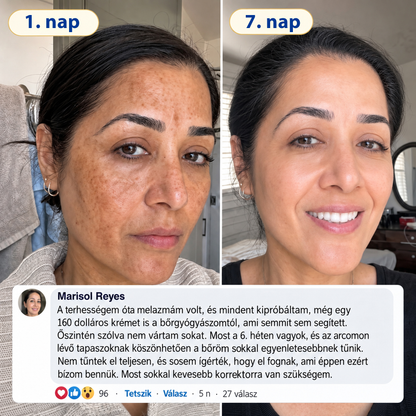 ✨𝑯𝒊𝒗𝒂𝒕𝒂𝒍𝒐𝒔 𝑼̈𝒛𝒍𝒆𝒕 | 𝐔́𝐣! ✨ Medistart® 𝐊𝐮𝐫𝐤𝐮𝐦𝐚 × 𝐊𝐨𝐣𝐢𝐧𝐬𝐚𝐯 𝐄́𝐣𝐬𝐳𝐚𝐤𝐚𝐢 Bőrfiatalító 𝐊𝐫𝐞́𝐦— 𝐇𝐚𝐥𝐯𝐚́𝐧𝐲𝐢́𝐭𝐬𝐝 𝐚 𝐦𝐚𝐤𝐚𝐜𝐬 𝐬𝐨̈𝐭𝐞́𝐭 𝐟𝐨𝐥𝐭𝐨𝐤𝐚𝐭 𝐞́𝐬 𝐬𝐢𝐦𝐢́𝐭𝐬𝐝 𝐤𝐢 𝐚 𝐥𝐚́𝐭𝐡𝐚𝐭𝐨́ 𝐫𝐚́𝐧𝐜𝐨𝐤𝐚𝐭 𝐚𝐥𝐯𝐚́𝐬 𝐤𝐨̈𝐳𝐛𝐞𝐧 🌙 ✅ 𝐄́𝐣𝐬𝐳𝐚𝐤𝐚́𝐧𝐤𝐞́𝐧𝐭 𝐞𝐠𝐲 𝐥𝐞́𝐩𝐞́𝐬 · 𝐋𝐚́𝐭𝐡𝐚𝐭𝐨́ 𝐯𝐚́𝐥𝐭𝐨𝐳𝐚́𝐬 𝟕 𝐞́𝐣𝐬𝐳𝐚𝐤𝐚 𝐚𝐥𝐚𝐭𝐭 💯