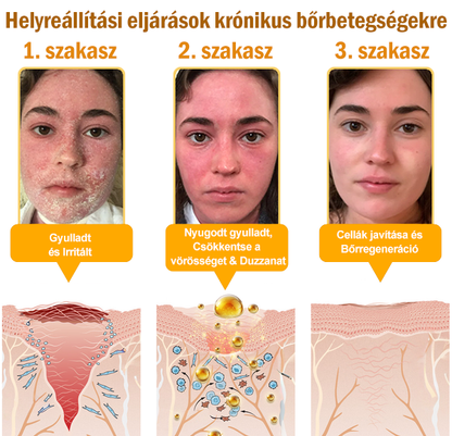 ✨✨Bőrgyógyász ajánlása ✨ ZödVita® Méhméreg Bőr Helyreállító Krém – Időskori purpura, ráncok és a bőr állapotának látványos javítása 💜 Magyar fejlesztés, magyarországi gyártás és szállítás