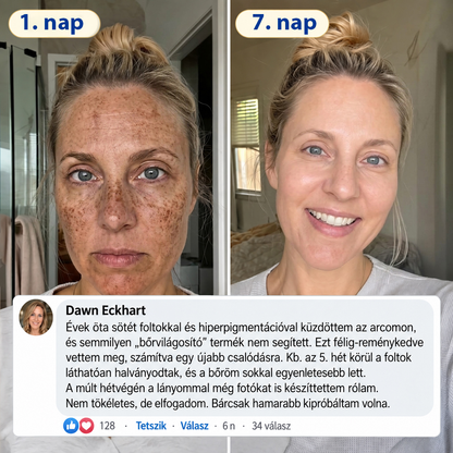 ✨𝑯𝒊𝒗𝒂𝒕𝒂𝒍𝒐𝒔 𝑼̈𝒛𝒍𝒆𝒕 | 𝐔́𝐣! ✨ Medistart® 𝐊𝐮𝐫𝐤𝐮𝐦𝐚 × 𝐊𝐨𝐣𝐢𝐧𝐬𝐚𝐯 𝐄́𝐣𝐬𝐳𝐚𝐤𝐚𝐢 Bőrfiatalító 𝐊𝐫𝐞́𝐦— 𝐇𝐚𝐥𝐯𝐚́𝐧𝐲𝐢́𝐭𝐬𝐝 𝐚 𝐦𝐚𝐤𝐚𝐜𝐬 𝐬𝐨̈𝐭𝐞́𝐭 𝐟𝐨𝐥𝐭𝐨𝐤𝐚𝐭 𝐞́𝐬 𝐬𝐢𝐦𝐢́𝐭𝐬𝐝 𝐤𝐢 𝐚 𝐥𝐚́𝐭𝐡𝐚𝐭𝐨́ 𝐫𝐚́𝐧𝐜𝐨𝐤𝐚𝐭 𝐚𝐥𝐯𝐚́𝐬 𝐤𝐨̈𝐳𝐛𝐞𝐧 🌙 ✅ 𝐄́𝐣𝐬𝐳𝐚𝐤𝐚́𝐧𝐤𝐞́𝐧𝐭 𝐞𝐠𝐲 𝐥𝐞́𝐩𝐞́𝐬 · 𝐋𝐚́𝐭𝐡𝐚𝐭𝐨́ 𝐯𝐚́𝐥𝐭𝐨𝐳𝐚́𝐬 𝟕 𝐞́𝐣𝐬𝐳𝐚𝐤𝐚 𝐚𝐥𝐚𝐭𝐭 💯