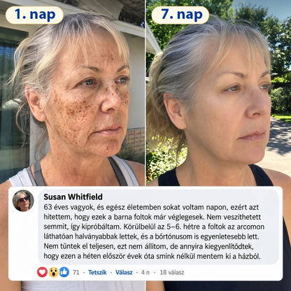 ✨𝑯𝒊𝒗𝒂𝒕𝒂𝒍𝒐𝒔 𝑼̈𝒛𝒍𝒆𝒕 | 𝐔́𝐣! ✨ Medistart® 𝐊𝐮𝐫𝐤𝐮𝐦𝐚 × 𝐊𝐨𝐣𝐢𝐧𝐬𝐚𝐯 𝐄́𝐣𝐬𝐳𝐚𝐤𝐚𝐢 Bőrfiatalító 𝐊𝐫𝐞́𝐦— 𝐇𝐚𝐥𝐯𝐚́𝐧𝐲𝐢́𝐭𝐬𝐝 𝐚 𝐦𝐚𝐤𝐚𝐜𝐬 𝐬𝐨̈𝐭𝐞́𝐭 𝐟𝐨𝐥𝐭𝐨𝐤𝐚𝐭 𝐞́𝐬 𝐬𝐢𝐦𝐢́𝐭𝐬𝐝 𝐤𝐢 𝐚 𝐥𝐚́𝐭𝐡𝐚𝐭𝐨́ 𝐫𝐚́𝐧𝐜𝐨𝐤𝐚𝐭 𝐚𝐥𝐯𝐚́𝐬 𝐤𝐨̈𝐳𝐛𝐞𝐧 🌙 ✅ 𝐄́𝐣𝐬𝐳𝐚𝐤𝐚́𝐧𝐤𝐞́𝐧𝐭 𝐞𝐠𝐲 𝐥𝐞́𝐩𝐞́𝐬 · 𝐋𝐚́𝐭𝐡𝐚𝐭𝐨́ 𝐯𝐚́𝐥𝐭𝐨𝐳𝐚́𝐬 𝟕 𝐞́𝐣𝐬𝐳𝐚𝐤𝐚 𝐚𝐥𝐚𝐭𝐭 💯
