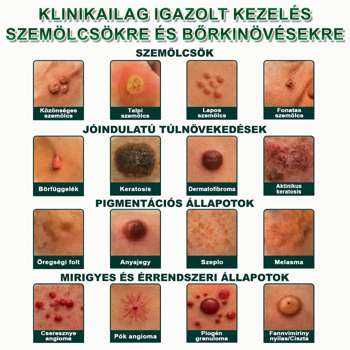 𝐏𝐮𝐫𝐚𝐂𝐮𝐫𝐞® 𝐌𝐈𝐊𝐑𝐎𝐓Ű𝐒 𝐁Ő𝐑𝐊𝐈𝐍Ö𝐕É𝐒-𝐄𝐋𝐓Á𝐕𝐎𝐋Í𝐓Ó 𝐓𝐀𝐏𝐀𝐒𝐙𝐎𝐊 —𝟕 𝐍𝐀𝐏𝐎𝐒 𝐂É𝐋𝐙𝐎𝐓𝐓 𝐄𝐋𝐓Á𝐕𝐎𝐋Í𝐓Á𝐒 𝐁Ő𝐑𝐍𝐘Ú𝐋𝐕Á𝐍𝐘𝐎𝐊, 𝐒𝐙𝐄𝐌Ö𝐋𝐂𝐒Ö𝐊 É𝐒 𝐊𝐈𝐄𝐌𝐄𝐋𝐊𝐄𝐃Ő 𝐁Ő𝐑𝐇𝐈𝐁Á𝐊 𝐄𝐋𝐋𝐄𝐍