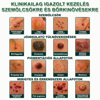 𝐏𝐮𝐫𝐚𝐂𝐮𝐫𝐞® 𝐌𝐈𝐊𝐑𝐎𝐓Ű𝐒 𝐁Ő𝐑𝐊𝐈𝐍Ö𝐕É𝐒-𝐄𝐋𝐓Á𝐕𝐎𝐋Í𝐓Ó 𝐓𝐀𝐏𝐀𝐒𝐙𝐎𝐊 —𝟕 𝐍𝐀𝐏𝐎𝐒 𝐂É𝐋𝐙𝐎𝐓𝐓 𝐄𝐋𝐓Á𝐕𝐎𝐋Í𝐓Á𝐒 𝐁Ő𝐑𝐍𝐘Ú𝐋𝐕Á𝐍𝐘𝐎𝐊, 𝐒𝐙𝐄𝐌Ö𝐋𝐂𝐒Ö𝐊 É𝐒 𝐊𝐈𝐄𝐌𝐄𝐋𝐊𝐄𝐃Ő 𝐁Ő𝐑𝐇𝐈𝐁Á𝐊 𝐄𝐋𝐋𝐄𝐍
