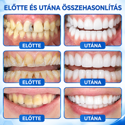 🌟PuraCure®  Üregjavító Természetes Zománctömő Gél
