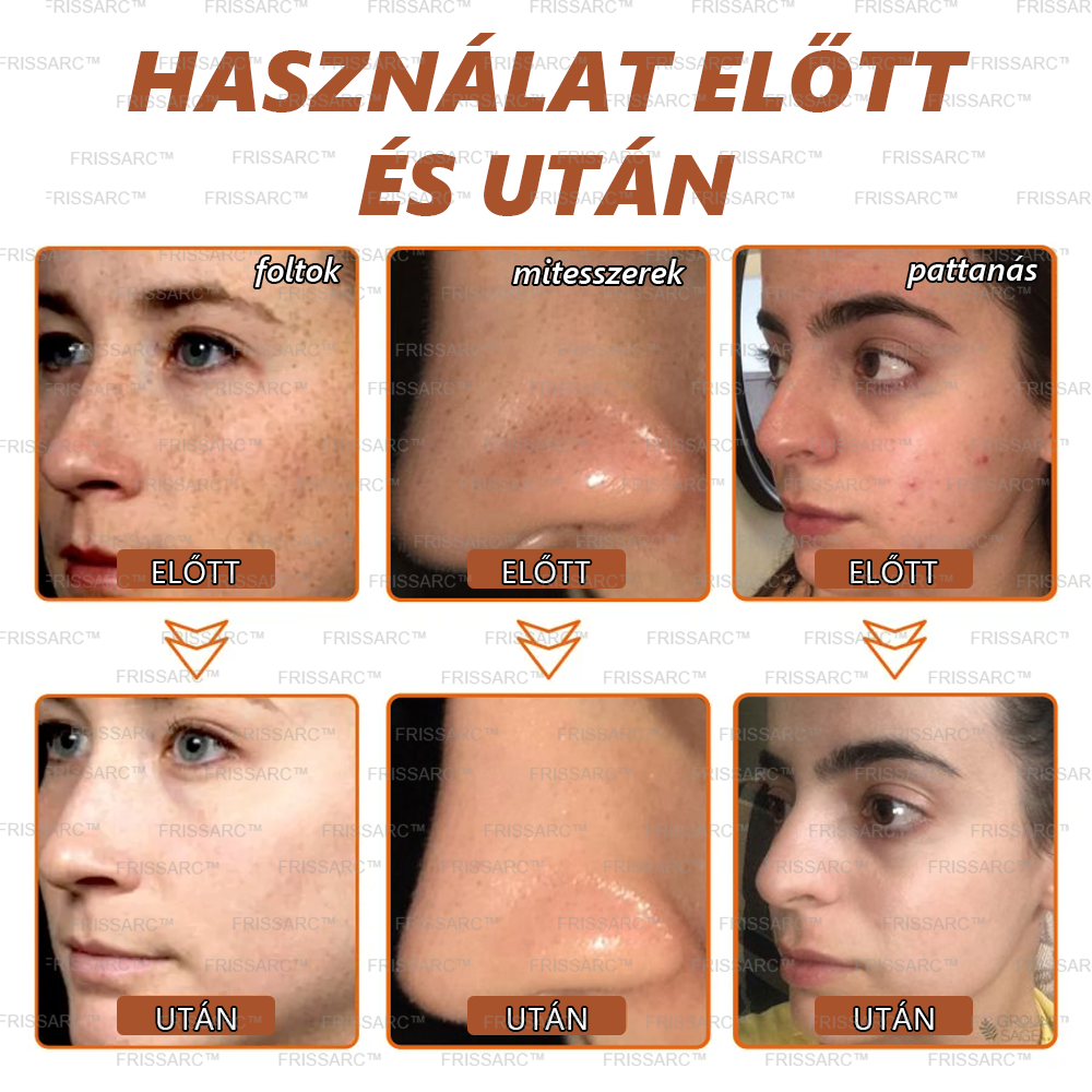 🎁𝐅𝐑𝐈𝐒𝐒𝐀𝐑𝐂™ Arcmaszk | Látható folthalványítás természetes összetevőkkel – szeplőkre, pigmentfoltokra, napkárosodásra🎁