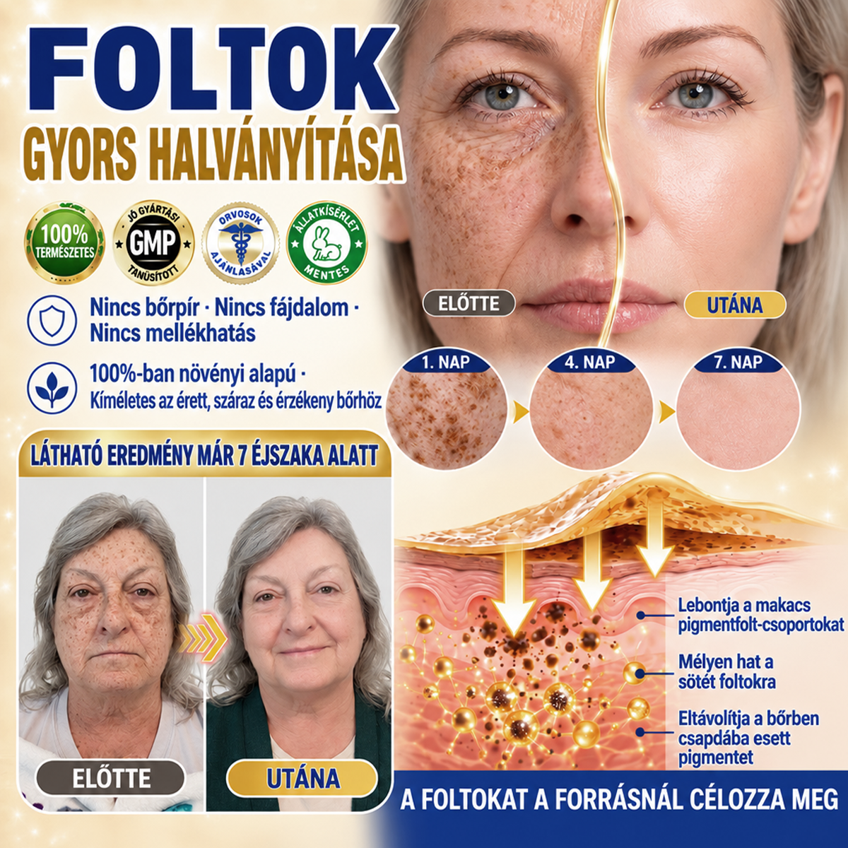 ✨𝑯𝒊𝒗𝒂𝒕𝒂𝒍𝒐𝒔 𝑼̈𝒛𝒍𝒆𝒕 | 𝐔́𝐣! ✨ Medistart® 𝐊𝐮𝐫𝐤𝐮𝐦𝐚 × 𝐊𝐨𝐣𝐢𝐧𝐬𝐚𝐯 𝐄́𝐣𝐬𝐳𝐚𝐤𝐚𝐢 Bőrfiatalító 𝐊𝐫𝐞́𝐦— 𝐇𝐚𝐥𝐯𝐚́𝐧𝐲𝐢́𝐭𝐬𝐝 𝐚 𝐦𝐚𝐤𝐚𝐜𝐬 𝐬𝐨̈𝐭𝐞́𝐭 𝐟𝐨𝐥𝐭𝐨𝐤𝐚𝐭 𝐞́𝐬 𝐬𝐢𝐦𝐢́𝐭𝐬𝐝 𝐤𝐢 𝐚 𝐥𝐚́𝐭𝐡𝐚𝐭𝐨́ 𝐫𝐚́𝐧𝐜𝐨𝐤𝐚𝐭 𝐚𝐥𝐯𝐚́𝐬 𝐤𝐨̈𝐳𝐛𝐞𝐧 🌙 ✅ 𝐄́𝐣𝐬𝐳𝐚𝐤𝐚́𝐧𝐤𝐞́𝐧𝐭 𝐞𝐠𝐲 𝐥𝐞́𝐩𝐞́𝐬 · 𝐋𝐚́𝐭𝐡𝐚𝐭𝐨́ 𝐯𝐚́𝐥𝐭𝐨𝐳𝐚́𝐬 𝟕 𝐞́𝐣𝐬𝐳𝐚𝐤𝐚 𝐚𝐥𝐚𝐭𝐭 💯