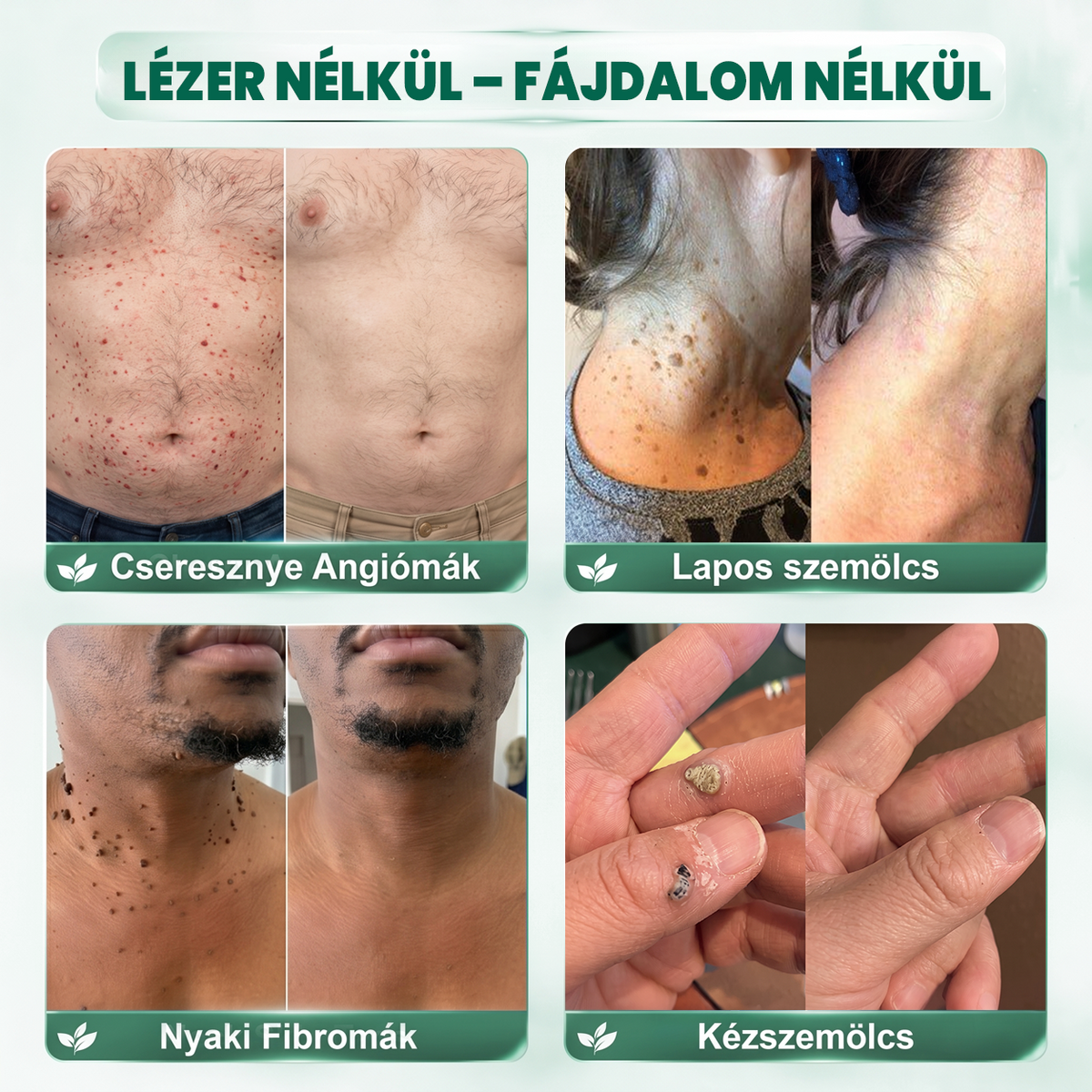 𝐏𝐮𝐫𝐚𝐂𝐮𝐫𝐞® 𝐌𝐈𝐊𝐑𝐎𝐓Ű𝐒 𝐁Ő𝐑𝐊𝐈𝐍Ö𝐕É𝐒-𝐄𝐋𝐓Á𝐕𝐎𝐋Í𝐓Ó 𝐓𝐀𝐏𝐀𝐒𝐙𝐎𝐊 —𝟕 𝐍𝐀𝐏𝐎𝐒 𝐂É𝐋𝐙𝐎𝐓𝐓 𝐄𝐋𝐓Á𝐕𝐎𝐋Í𝐓Á𝐒 𝐁Ő𝐑𝐍𝐘Ú𝐋𝐕Á𝐍𝐘𝐎𝐊, 𝐒𝐙𝐄𝐌Ö𝐋𝐂𝐒Ö𝐊 É𝐒 𝐊𝐈𝐄𝐌𝐄𝐋𝐊𝐄𝐃Ő 𝐁Ő𝐑𝐇𝐈𝐁Á𝐊 𝐄𝐋𝐋𝐄𝐍