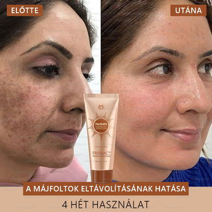 🎁𝐅𝐑𝐈𝐒𝐒𝐀𝐑𝐂™ Arcmaszk | Látható folthalványítás természetes összetevőkkel – szeplőkre, pigmentfoltokra, napkárosodásra🎁