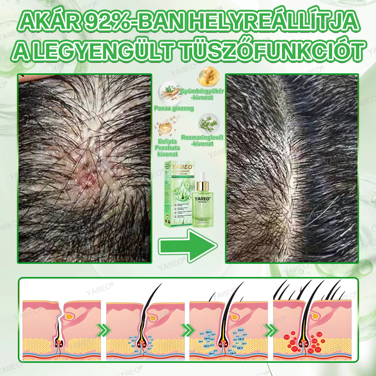 🌿 𝒀𝑨𝑰𝑰𝑬𝑶® 𝑯𝒂𝒋𝒔𝒆𝒓𝒌𝒆𝒏𝒕ő 𝑺𝒛é𝒓𝒖𝒎 – 𝑭á𝒋𝒅𝒂𝒍𝒐𝒎𝒎𝒆𝒏𝒕𝒆𝒔 𝑯𝒂𝒋á𝒑𝒐𝒍á𝒔 Közvetlenül a hajhagymák gyökeréig · 4 hét alatt újraéleszti az alvó tüszőket · EU CE tanúsítvány