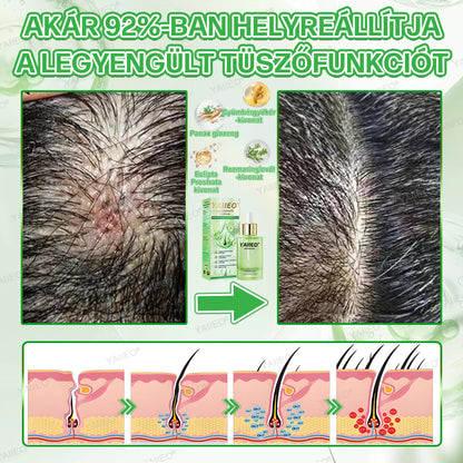🌿 𝒀𝑨𝑰𝑰𝑬𝑶® 𝑯𝒂𝒋𝒔𝒆𝒓𝒌𝒆𝒏𝒕ő 𝑺𝒛é𝒓𝒖𝒎 – 𝑭á𝒋𝒅𝒂𝒍𝒐𝒎𝒎𝒆𝒏𝒕𝒆𝒔 𝑯𝒂𝒋á𝒑𝒐𝒍á𝒔 Közvetlenül a hajhagymák gyökeréig · 4 hét alatt újraéleszti az alvó tüszőket · EU CE tanúsítvány