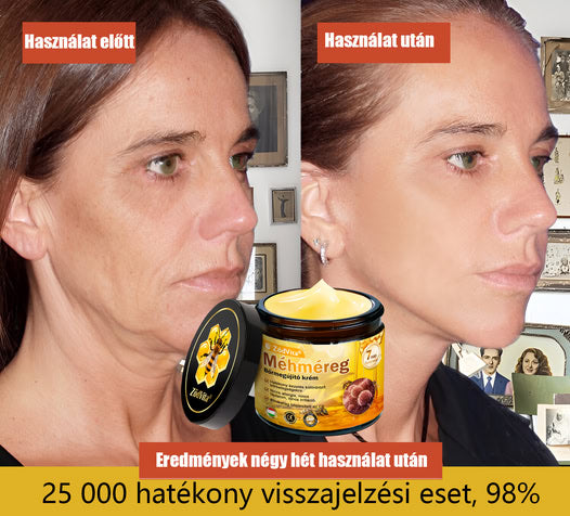 🎁 Bőrgyógyász ajánlása ✨ ZödVita® Méhméreg Bőr Helyreállító Krém 🔥 Magyar fejlesztés, magyarországi gyártás és szállítás🎁