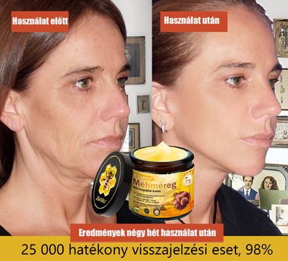 🎁 Bőrgyógyász ajánlása ✨ ZödVita® Méhméreg Bőr Helyreállító Krém 🔥 Magyar fejlesztés, magyarországi gyártás és szállítás🎁