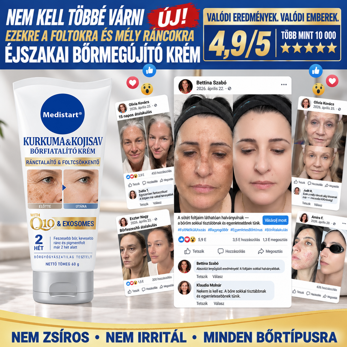✨𝑯𝒊𝒗𝒂𝒕𝒂𝒍𝒐𝒔 𝑼̈𝒛𝒍𝒆𝒕 | 𝐔́𝐣! ✨ Medistart® 𝐊𝐮𝐫𝐤𝐮𝐦𝐚 × 𝐊𝐨𝐣𝐢𝐧𝐬𝐚𝐯 𝐄́𝐣𝐬𝐳𝐚𝐤𝐚𝐢 Bőrfiatalító 𝐊𝐫𝐞́𝐦— 𝐇𝐚𝐥𝐯𝐚́𝐧𝐲𝐢́𝐭𝐬𝐝 𝐚 𝐦𝐚𝐤𝐚𝐜𝐬 𝐬𝐨̈𝐭𝐞́𝐭 𝐟𝐨𝐥𝐭𝐨𝐤𝐚𝐭 𝐞́𝐬 𝐬𝐢𝐦𝐢́𝐭𝐬𝐝 𝐤𝐢 𝐚 𝐥𝐚́𝐭𝐡𝐚𝐭𝐨́ 𝐫𝐚́𝐧𝐜𝐨𝐤𝐚𝐭 𝐚𝐥𝐯𝐚́𝐬 𝐤𝐨̈𝐳𝐛𝐞𝐧 🌙 ✅ 𝐄́𝐣𝐬𝐳𝐚𝐤𝐚́𝐧𝐤𝐞́𝐧𝐭 𝐞𝐠𝐲 𝐥𝐞́𝐩𝐞́𝐬 · 𝐋𝐚́𝐭𝐡𝐚𝐭𝐨́ 𝐯𝐚́𝐥𝐭𝐨𝐳𝐚́𝐬 𝟕 𝐞́𝐣𝐬𝐳𝐚𝐤𝐚 𝐚𝐥𝐚𝐭𝐭 💯