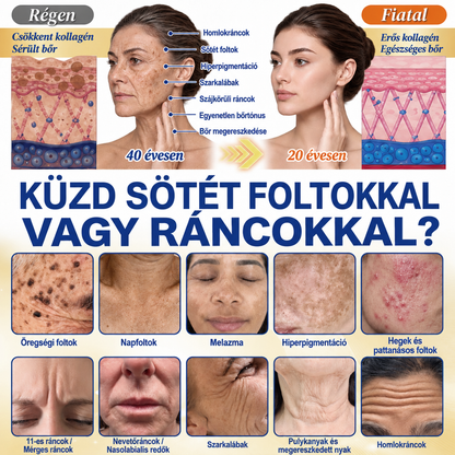 ✨𝑯𝒊𝒗𝒂𝒕𝒂𝒍𝒐𝒔 𝑼̈𝒛𝒍𝒆𝒕 | 𝐔́𝐣! ✨ Medistart® 𝐊𝐮𝐫𝐤𝐮𝐦𝐚 × 𝐊𝐨𝐣𝐢𝐧𝐬𝐚𝐯 𝐄́𝐣𝐬𝐳𝐚𝐤𝐚𝐢 Bőrfiatalító 𝐊𝐫𝐞́𝐦— 𝐇𝐚𝐥𝐯𝐚́𝐧𝐲𝐢́𝐭𝐬𝐝 𝐚 𝐦𝐚𝐤𝐚𝐜𝐬 𝐬𝐨̈𝐭𝐞́𝐭 𝐟𝐨𝐥𝐭𝐨𝐤𝐚𝐭 𝐞́𝐬 𝐬𝐢𝐦𝐢́𝐭𝐬𝐝 𝐤𝐢 𝐚 𝐥𝐚́𝐭𝐡𝐚𝐭𝐨́ 𝐫𝐚́𝐧𝐜𝐨𝐤𝐚𝐭 𝐚𝐥𝐯𝐚́𝐬 𝐤𝐨̈𝐳𝐛𝐞𝐧 🌙 ✅ 𝐄́𝐣𝐬𝐳𝐚𝐤𝐚́𝐧𝐤𝐞́𝐧𝐭 𝐞𝐠𝐲 𝐥𝐞́𝐩𝐞́𝐬 · 𝐋𝐚́𝐭𝐡𝐚𝐭𝐨́ 𝐯𝐚́𝐥𝐭𝐨𝐳𝐚́𝐬 𝟕 𝐞́𝐣𝐬𝐳𝐚𝐤𝐚 𝐚𝐥𝐚𝐭𝐭 💯