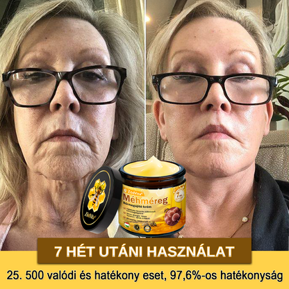 📦 Bőrgyógyász ajánlása ✨ ZödVita® Méhméreg Bőr Helyreállító Krém 🔥 Magyar fejlesztés, magyarországi gyártás és szállítás