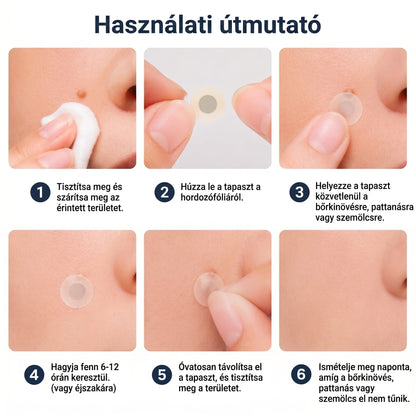 ✨ PuraCure® 2 az 1-ben mikrotűs és hidrokolloid tapasz🍀 | Kiálló anyajegyek, aknék, lapos szemölcsök és bőrnövedékek eltávolítására | Segít csökkenteni a ráncokat, hegeket és bőrhibákat | Láthatatlan tapasz az arcra és testre