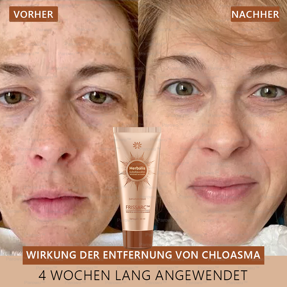 🎁𝐅𝐑𝐈𝐒𝐒𝐀𝐑𝐂™ Arcmaszk | Látható folthalványítás természetes összetevőkkel – szeplőkre, pigmentfoltokra, napkárosodásra🎁