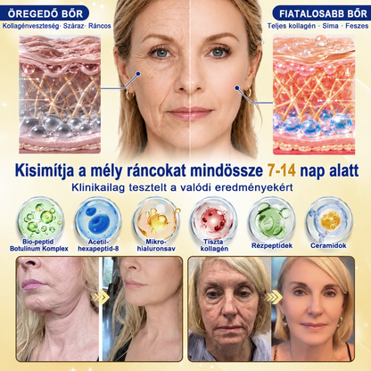 ✨𝑯𝒊𝒗𝒂𝒕𝒂𝒍𝒐𝒔 𝑼̈𝒛𝒍𝒆𝒕 | 𝐔́𝐣! ✨ Medistart® 𝐊𝐮𝐫𝐤𝐮𝐦𝐚 × 𝐊𝐨𝐣𝐢𝐧𝐬𝐚𝐯 𝐄́𝐣𝐬𝐳𝐚𝐤𝐚𝐢 Bőrfiatalító 𝐊𝐫𝐞́𝐦— 𝐇𝐚𝐥𝐯𝐚́𝐧𝐲𝐢́𝐭𝐬𝐝 𝐚 𝐦𝐚𝐤𝐚𝐜𝐬 𝐬𝐨̈𝐭𝐞́𝐭 𝐟𝐨𝐥𝐭𝐨𝐤𝐚𝐭 𝐞́𝐬 𝐬𝐢𝐦𝐢́𝐭𝐬𝐝 𝐤𝐢 𝐚 𝐥𝐚́𝐭𝐡𝐚𝐭𝐨́ 𝐫𝐚́𝐧𝐜𝐨𝐤𝐚𝐭 𝐚𝐥𝐯𝐚́𝐬 𝐤𝐨̈𝐳𝐛𝐞𝐧 🌙 ✅ 𝐄́𝐣𝐬𝐳𝐚𝐤𝐚́𝐧𝐤𝐞́𝐧𝐭 𝐞𝐠𝐲 𝐥𝐞́𝐩𝐞́𝐬 · 𝐋𝐚́𝐭𝐡𝐚𝐭𝐨́ 𝐯𝐚́𝐥𝐭𝐨𝐳𝐚́𝐬 𝟕 𝐞́𝐣𝐬𝐳𝐚𝐤𝐚 𝐚𝐥𝐚𝐭𝐭 💯