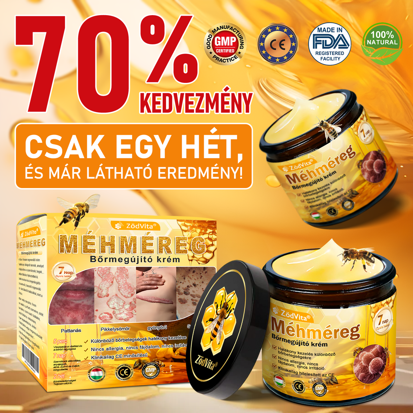 🔥Bőrgyógyász ajánlása ✨ ZödVita® Méhméreg Bőr Helyreállító Krém 🔥 Magyar fejlesztés, magyarországi gyártás és szállítás