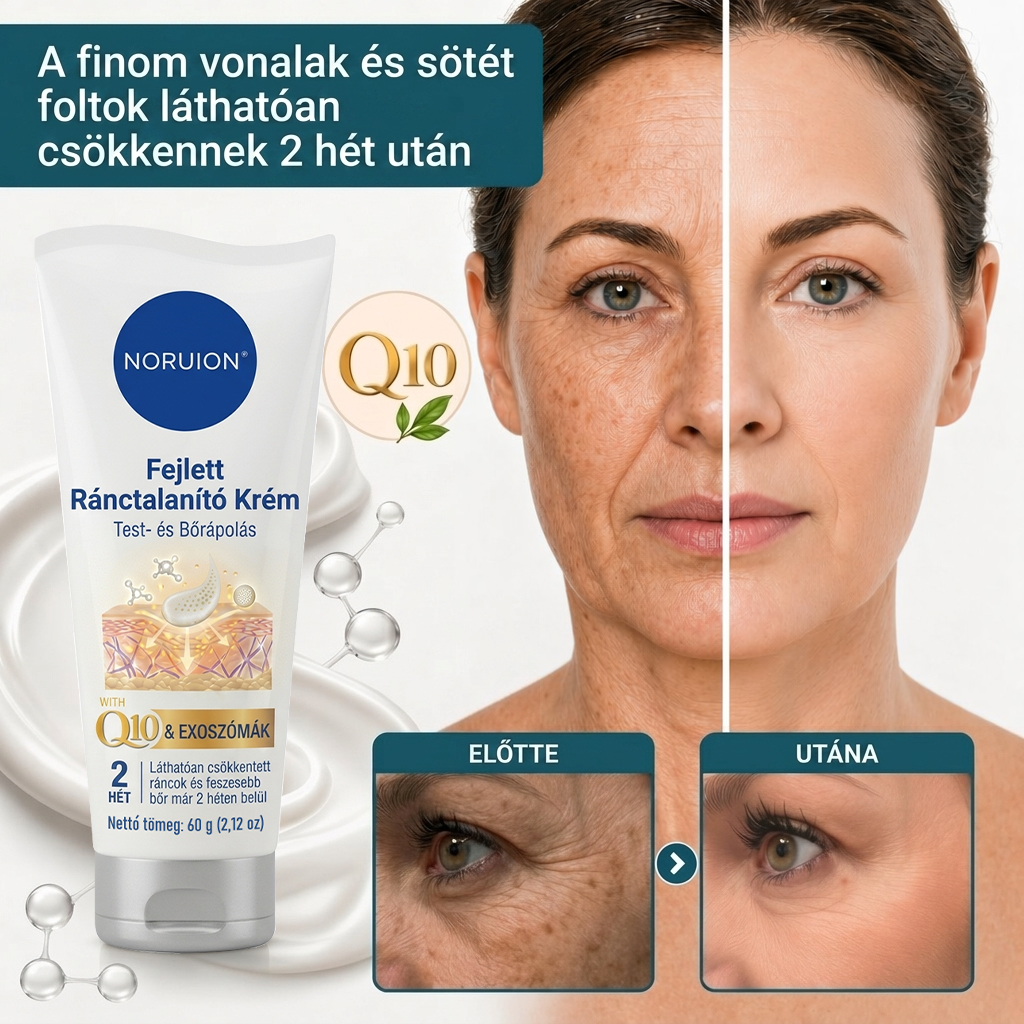 🌿 NORUION® Q10 + növényi nano-exoszóma fejlett ránctalanító krém