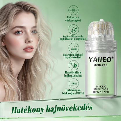🎁YAIIEO® 𝑭á𝒋𝒅𝒂𝒍𝒐𝒎𝒎𝒆𝒏𝒕𝒆𝒔 𝑴𝒊𝒌𝒓𝒐𝒊𝒏𝒇ú𝒛𝒊ó𝒔 𝑹𝒆𝒏𝒅𝒔𝒛𝒆𝒓🎁