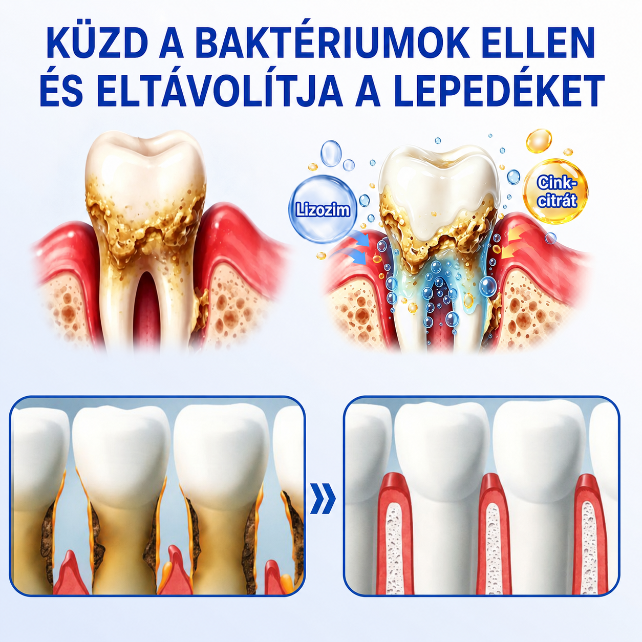 🇭🇺👨‍⚕️🌲🦷 PuraCure® ÍNYMEGÚJÍTÓ – Parodontális helyreállító gél🧂