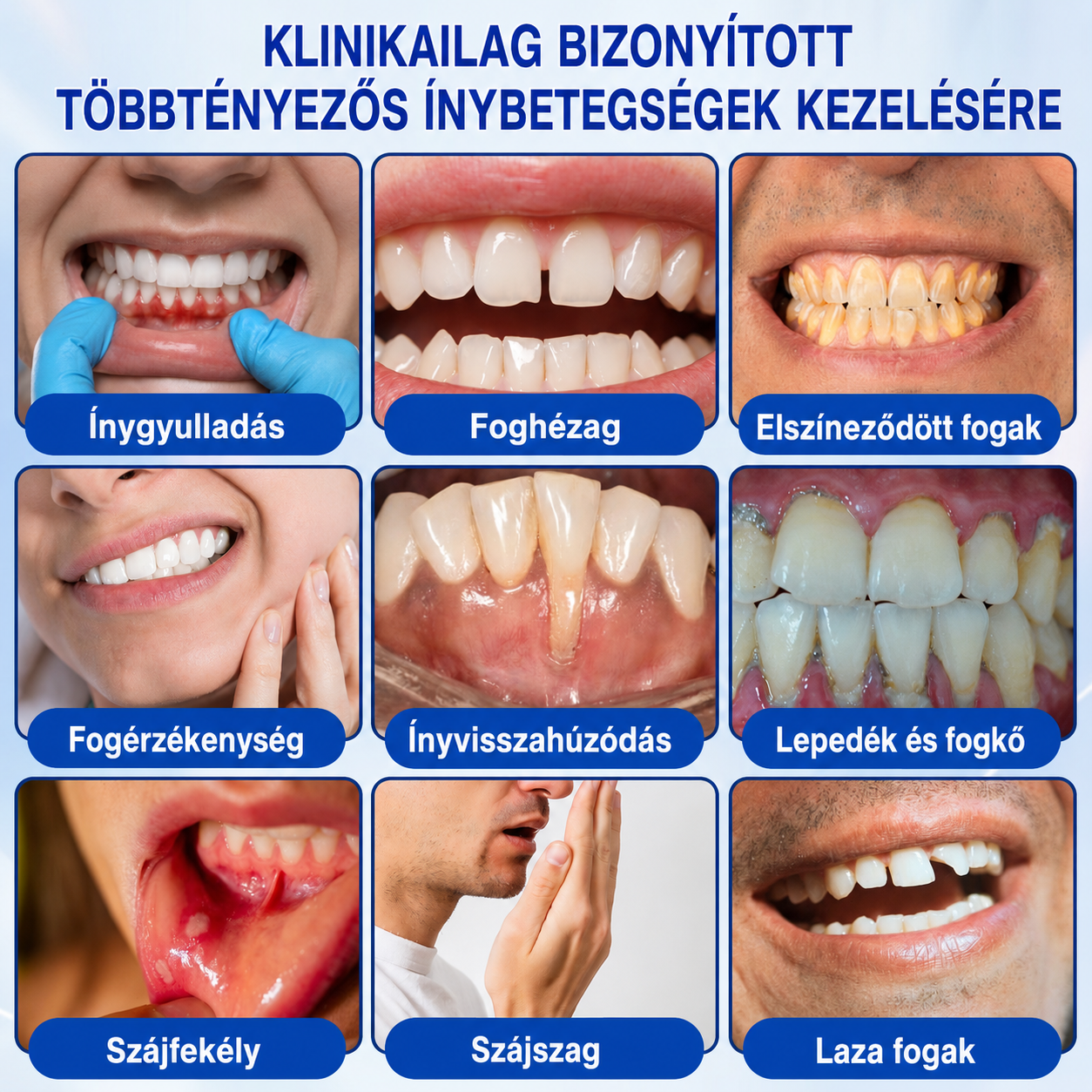 🇭🇺👨‍⚕️🌲🦷 PuraCure® ÍNYMEGÚJÍTÓ – Parodontális helyreállító gél🧂